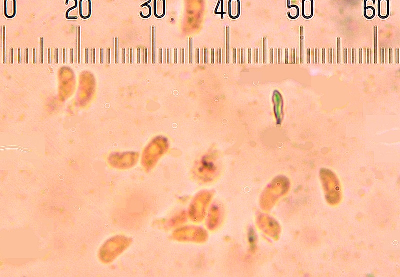 Sistotrema brinkmannii